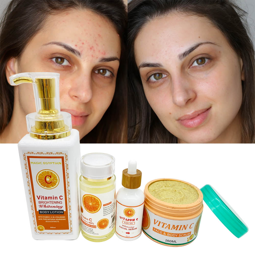 Kit De Soin Pour La Peau à La Vitamine C Lotion Pour Le Corps éclair Yoocon2 8702